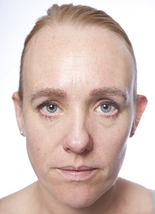 fml-anna pursglove 'after surgery eyebrow'-15.jpg
